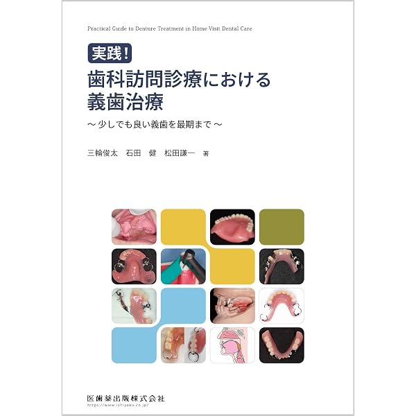 部分床義歯のルール 構成要素から導き出す成功の原則 Amazon.co.jp: 構成要素から導き出す成功の原則 部分床義歯のルール