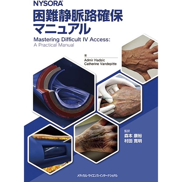 手術のための神経ブロック ビジュアル基本手技〜麻酔科医が知り