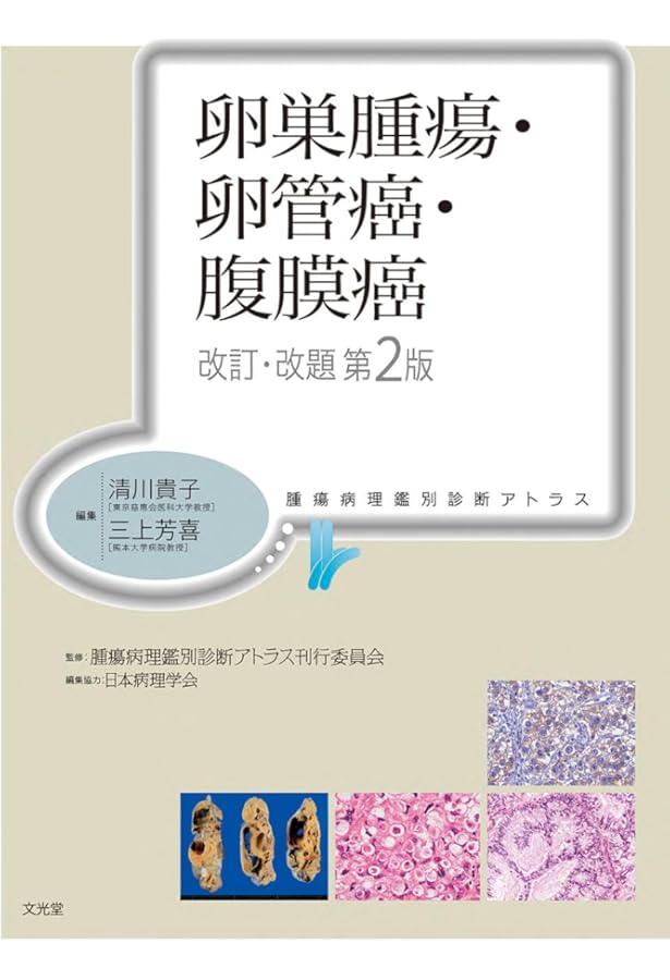 子宮体癌 第2版 (腫瘍病理鑑別診断アトラス) | 柳井広之, 笹島ゆう子