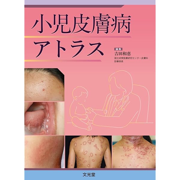 ●裁断済 子どもの皮膚疾患アトラス : 正常?病的?この症状は大丈夫? Amazon.co.jp: 子どもの皮膚疾患アトラス: 正常?病的?この症状は