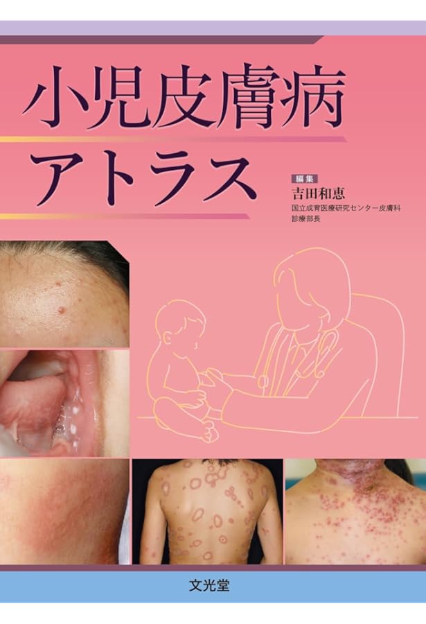 ●裁断済 子どもの皮膚疾患アトラス : 正常?病的?この症状は大丈夫? Amazon.co.jp: 子どもの皮膚疾患アトラス: 正常?病的?この症状は大丈夫