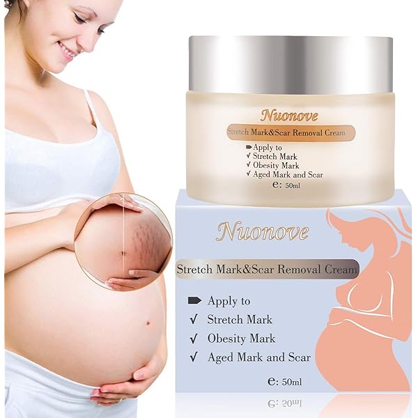 stomach stretch marks cream