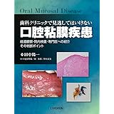 歯科クリニックで見逃してはいけない 口腔粘膜疾患