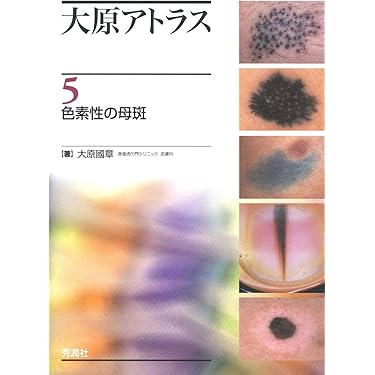 大原アトラス 5 色素性の母斑 | 大原國章 |本 | 通販 | Amazon