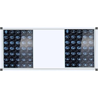 Amazon.co.jp 売れ筋ランキング: シャウカステン の中で最も人気のある