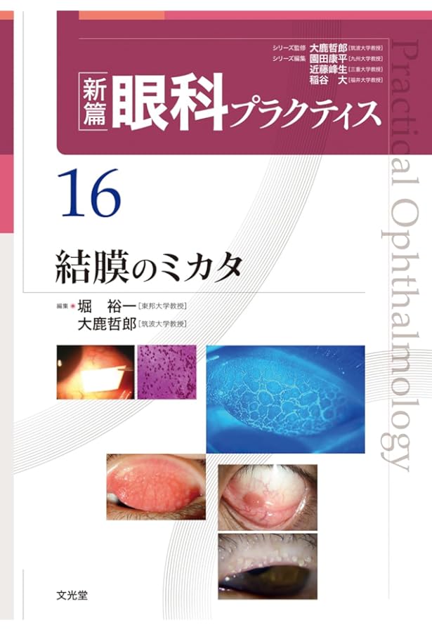 動画で学ぶ眼科処置・小手術の実際 | 外園千恵, 渡辺彰英 |本 | 通販