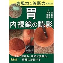 胃と腸アトラスI 上部消化管 第3版 | 「胃と腸」編集委員会, 蔵原 晃一
