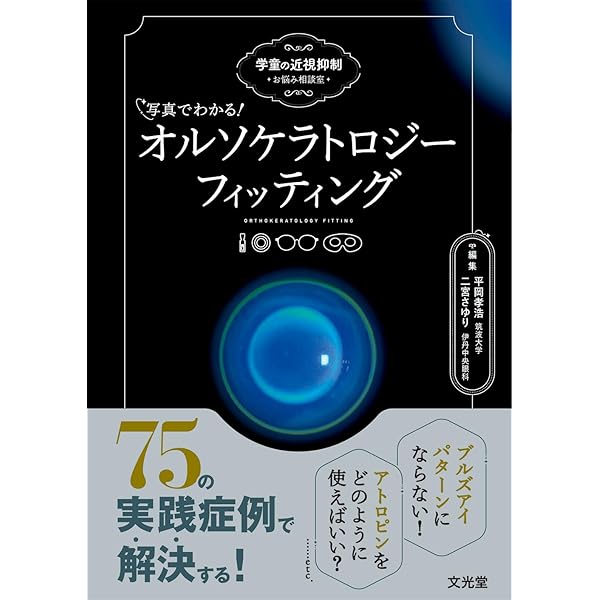 実践！ソフトコンタクトレンズ処方の最適解マニュアル | 梶田雅義 |本