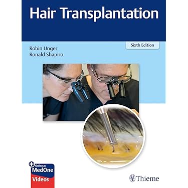 Amazon | Hair Transplantation | Unger, Robin MD, Shapiro