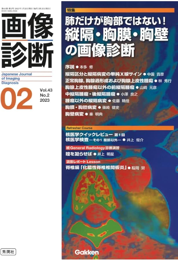 Amazon.co.jp: 画像診断 (2023年10月号Vol.43No.12) : 画像診断実行