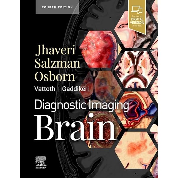 Amazon | Diagnostic Imaging: Spine | Ross MD, Jeffrey S., Moore MD