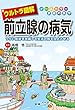 ウルトラ図解 前立腺の病気 (オールカラー家庭の医学)