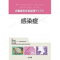感染症 (非腫瘍性疾患病理アトラス) | 栃木 直文, 鈴木 忠樹 |本
