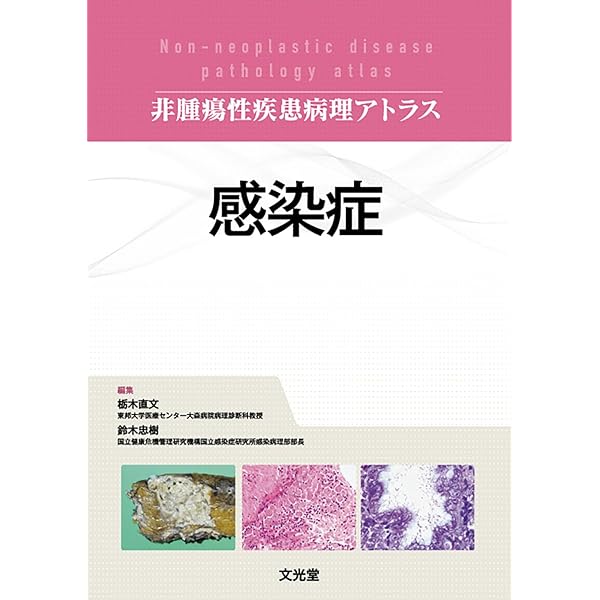 頭頸部 (非腫瘍性疾患病理アトラス) | 長尾俊孝, 長塚 仁, 湊 宏 |本