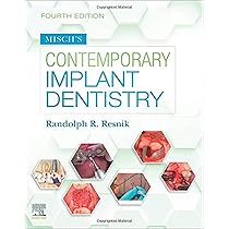 Functional Occlusion: From TMJ to Smile Design : Dawson DDS, Peter