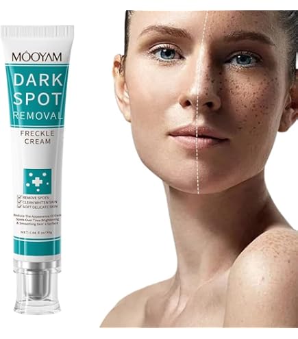 Amazon | VC ビタミンC クリーム vc誘導体 マルチビタミンC配合 シミ