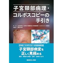 子宮頸部病理・コルポスコピーの手引き | 日本婦人科腫瘍学会 子宮頸部