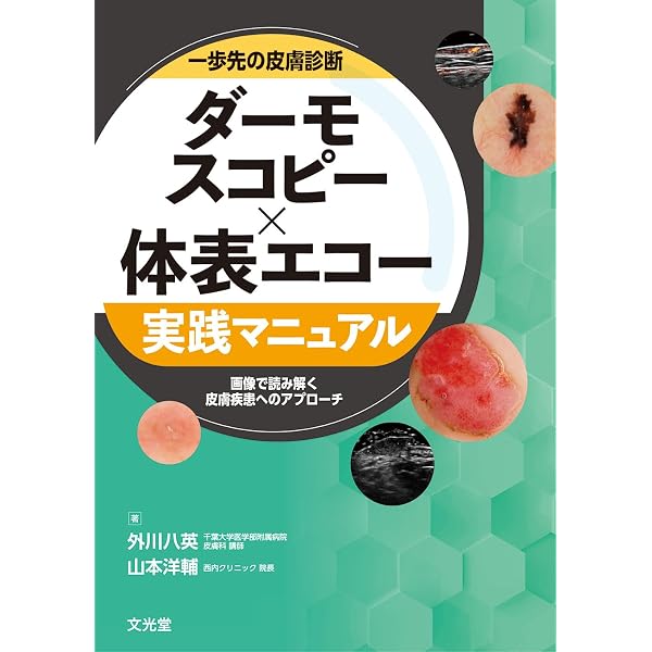 ビジュアル解説 皮膚科マスト小外科手技 “一目瞭然”の基本テキスト