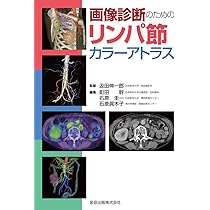 画像診断のためのリンパ節カラーアトラス | 汲田 伸一郎 |本