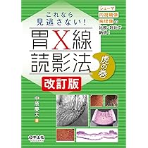 これなら見逃さない！胃X線読影法 虎の巻 改訂版〜シェーマ＋内視鏡像
