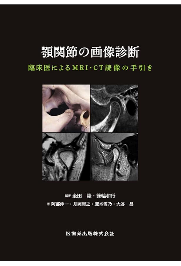 新編 顎関節症 第3版 | 日本顎関節学会, 依田 哲也, 小見山 道, 五十嵐