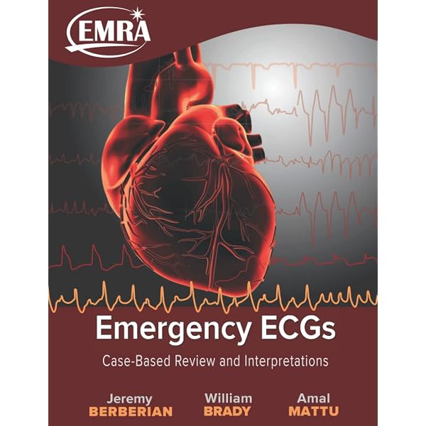 Amazon | Chou's Electrocardiography in Clinical Practice: Adult