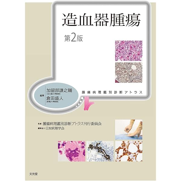 【裁断済】WHO分類第5版に基づくリンパ腫の診断 WHO分類第5版に基づくリンパ腫の診断 | 中村 直哉, 富田 直人, 小池 淳