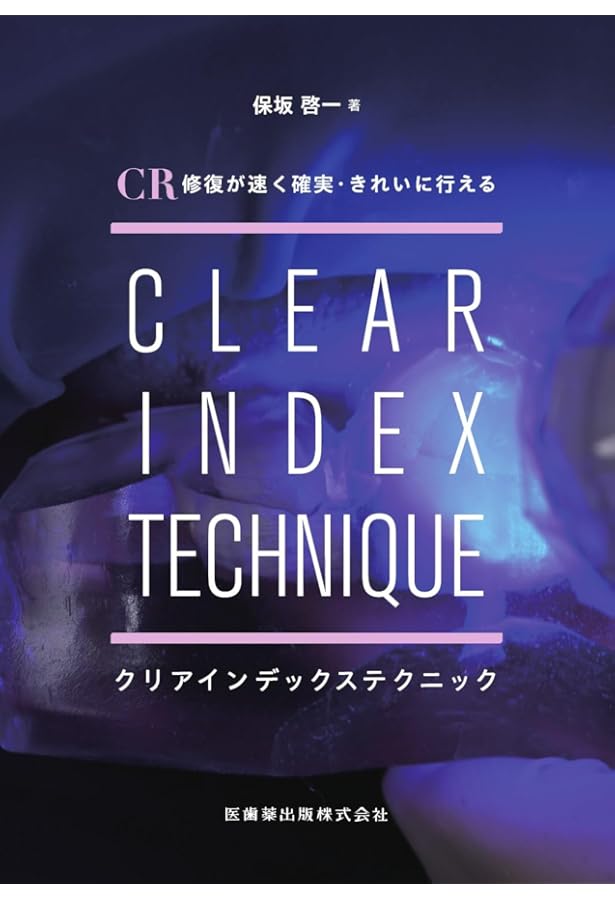 Amazon.co.jp: 手に取るようにわかるコンポジットレジン修復のメソッド