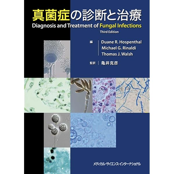 Amazon.co.jp: 深在性真菌症の診断・治療ガイドライン (2014) : 本
