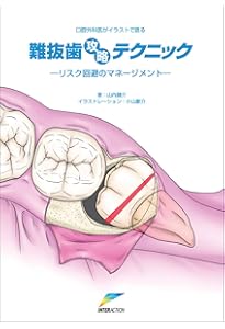 必ず上達 抜歯手技 増補新版 (必ず上達シリーズ) | 堀之内 康文 |本