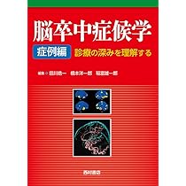 脳卒中症候学 | 田川 皓一 |本 | 通販 | Amazon