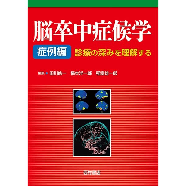 脳卒中症候学 症例編: 診療の深みを理解する | 田川皓一, 橋本洋一郎