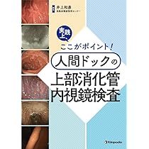 実践上、ここがポイント！ 人間ドックの上部消化管内視鏡検査