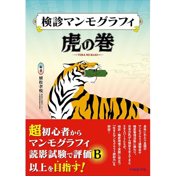 マンモグラフィ II 改訂版 マンモグラフィII 改訂版 読影力をアップさせる厳選62例