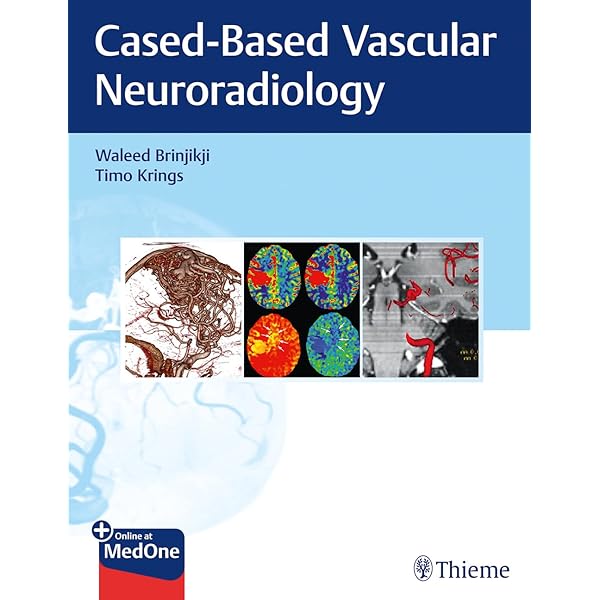 Amazon.co.jp: Decision Making in Neurovascular Disease