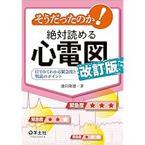 そうだったのか！絶対読める心電図 改訂版〜目でみてわかる緊急度と