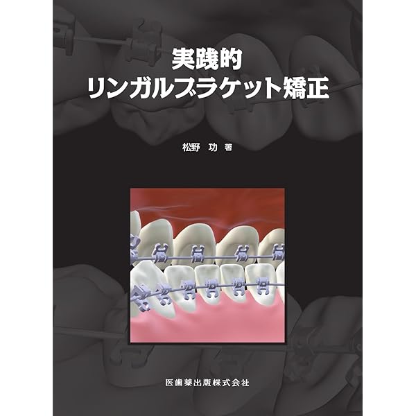 Amazon.co.jp: 臨床的治療効果を引き出す リンガルブラケット矯正法の 