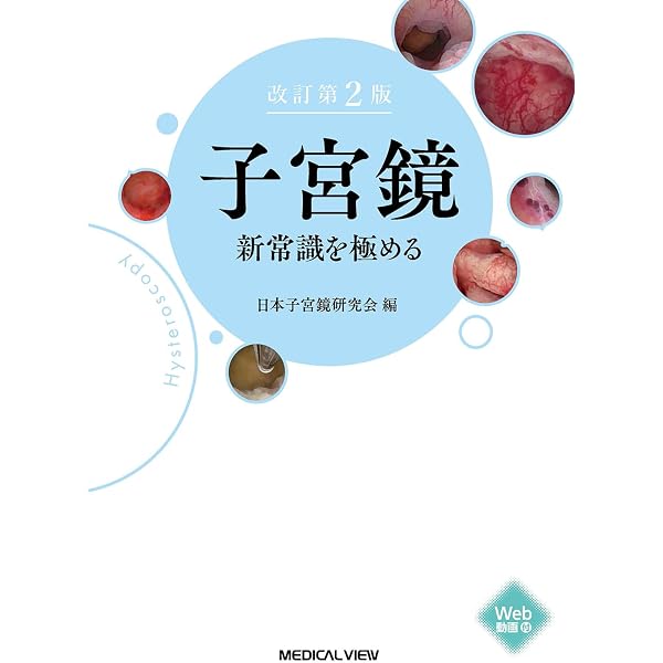 手術の前に読みたい 骨盤拡大手術のすべて | 上原 圭 |本 | 通販 | Amazon