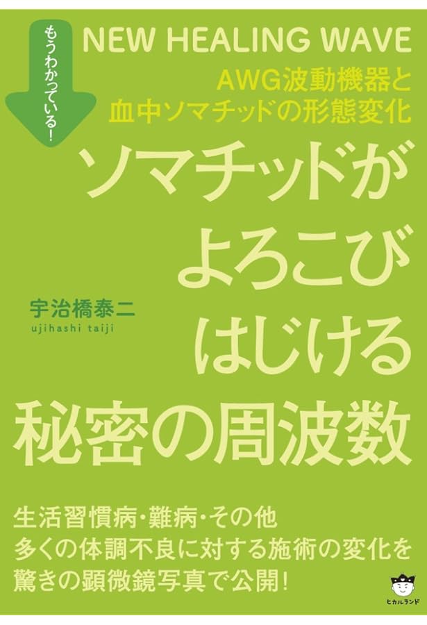 Amazon.co.jp: anemone別冊 驚異の古代生命体ソマチッド : 本