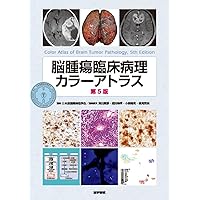 脳腫瘍治療学－腫瘍自然史と治療成績の分析から－ 第2版 | 松谷 雅生
