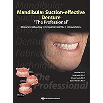 語学+参考書 Mandibular Suction-effective Denture The Professional"": Clinical and Laboratory Technique for Class I/Ii/iii With Aesthetics Mandibular Suction-Effective Denture, The Professional