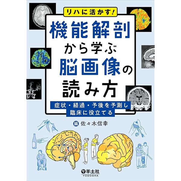 脳の機能解剖と画像診断 |本 | 通販 | Amazon 脳の機能解剖と画像診断