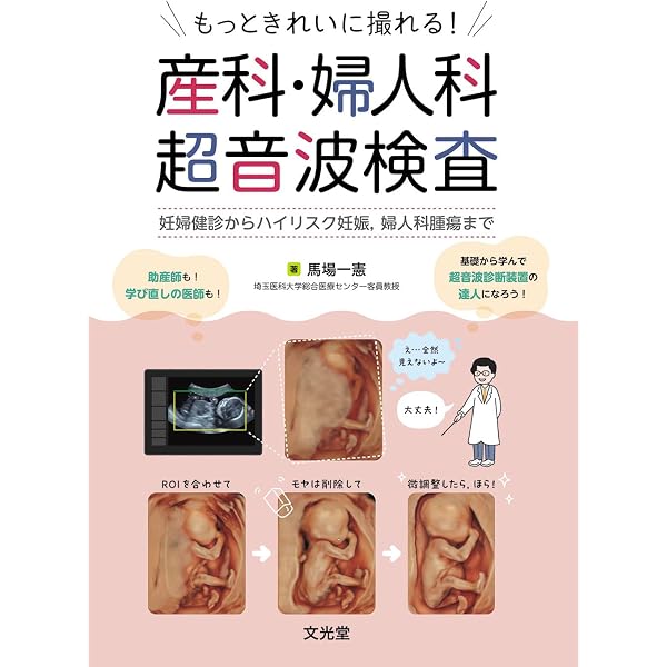 もっときれいに撮れる！産科・婦人科超音波検査 妊婦健診からハイ