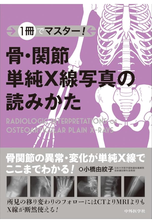 運動器画像診断マスターガイド (整形外科臨床パサージュ) | 耕三, 中村