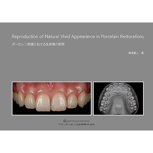 Amazon.co.jp: 天然歯の形態学 (1) : 脇田太裕: 本