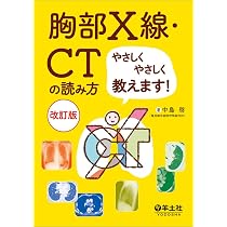Amazon.co.jp: 低線量肺がんCT検診の知識と実務(改訂4版) : NPO法人 