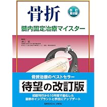 改訂第2版 骨折 髄内固定治療マイスター | 澤口 毅 |本 | 通販 | Amazon