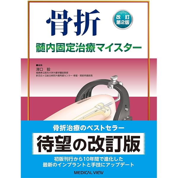 骨折―プレート治療マイスター | 毅, 澤口 |本 | 通販 | Amazon