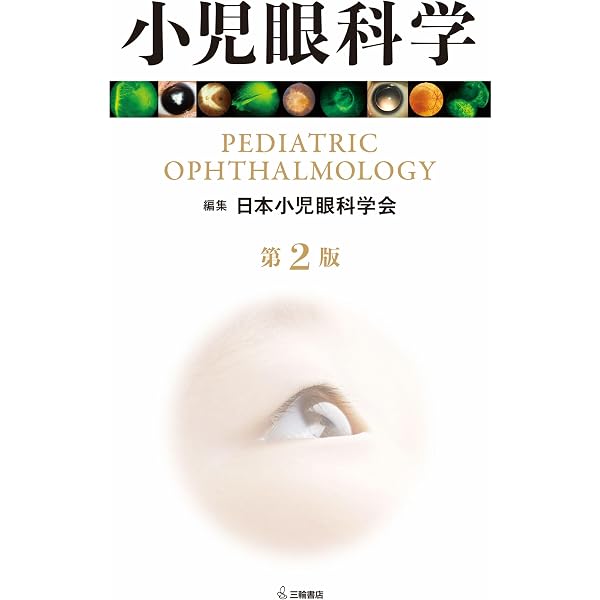 小児眼科学 第2版 | 日本小児眼科学会 |本 | 通販 | Amazon