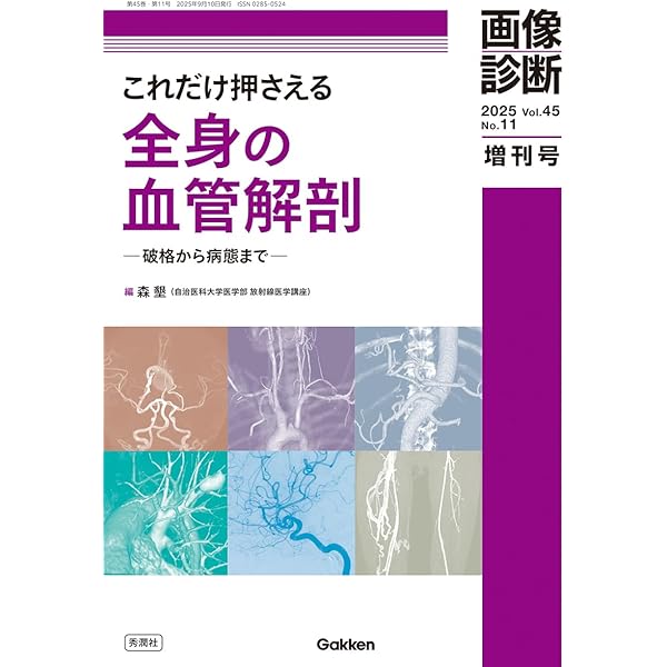 臨床画像 2020年4月増刊号 特集:放射線科医が知っておくべき脳血管障害診療 update 臨床画像 2020年4月増刊号 特集:放射線科医が知っておく
